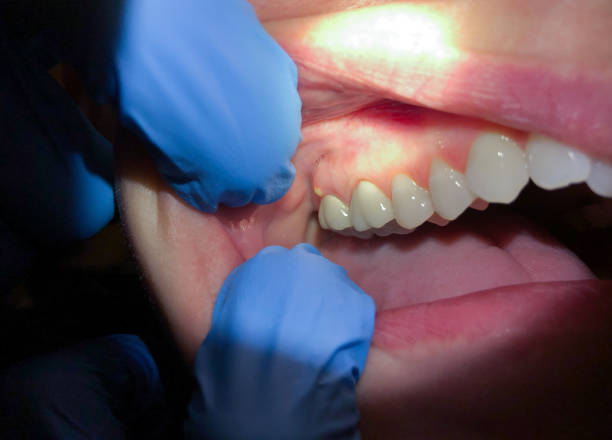 Best Urgent Dental Care  in Ome, GA