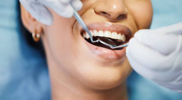 Best Urgent Tooth Repair  in Ome, GA